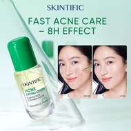 SKINTIFIC Acne Drying Lotion 8H Acne Solution|Niacinamide Fade Acne Scar|Reduce discomfort|Salicylic