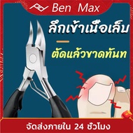 Benmax กรรไกรตัดเล็บ กรรไกรตัดเลบขบ กรรไกรตัดหนัง ที่ตัดเล็บขบ มีดตัดเล็บขบ ชุดตัดเล็บขบ ตัดเล็บขบ ก