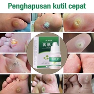 Foot Corn Warts Liquid Skin Tag Antibacterial Solution callus remover skin tag cream ubat ketuat bua