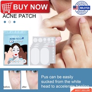 MH EELHOE / 80 Pcs 3M Face Quick Effect Multi-sized Acne Stickers / Removing Pimple Invisible Patche