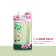 (1 Pack) New Bk Acne Clear Sika Water Gel Serum Reduces Moist Size 8g.