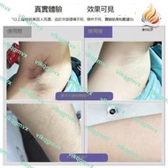 脫毛儀家用光子脫毛器多燈頭脫毛機全身無痛ipl冰點