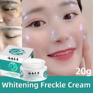 【Whitening+Spot Removal】Dark Spot Remover Whitening Freckle Cream Melasma Pigmentation Remover