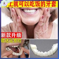gigi palsu silikon gigi palsu sarung Artifak makan pendakap tanpa gigi depan