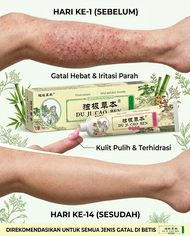 Salep Eksim Kering Gatal Kulit Mengelupas Paling Ampuh