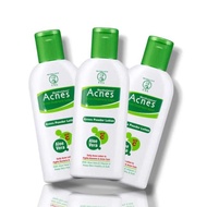 Acnes Powder Lotion - RITA