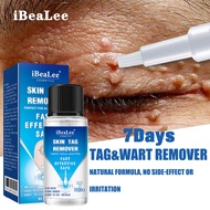 American Imported 7Days Skin Tag Removal Serum Warts Remover Pen Painless Papi
