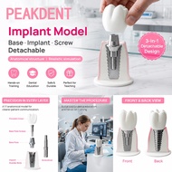 Detachable Large Dental Implant Model oral implant Dentist-patient communication demonstration Model