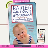 Babies With Down Syndrome: A New Parents' Guide