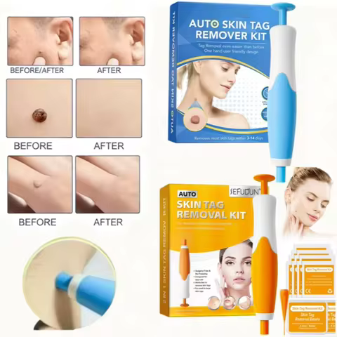1/2pcs 2 IN 1 Dual Head Auto Micro Skin Tag Remover Liquid Pen Flesh Mole Remover Chicken Eye Skin W