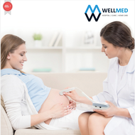 Jumper Angelsounds เครื่องฟังเสียงหัวใจทารกในครรภ์ รุ่น 100E - ชาร์จได้ แสดงผลแบบกราฟและตัวเลข