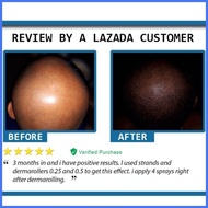 ♧ ❁ ✤ Minoxidil 6% Strands Hair Tonic Anti-Hair Loss Hair Growth Tonic