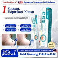 Wart Removal Warts Falling Ointment Flat Warts Warts Dedicated Filament Warts Sharp Wet Warts Metata
