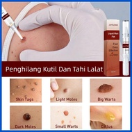 △ ◱ ∬ Warts remover original Mole remover Skin tag remover Removal freckle and melanin spots
