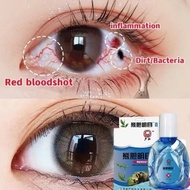 Pterygium Eye Repair Drops Eye Drops for Dry Eyes Itchy eyes Sore Eyes