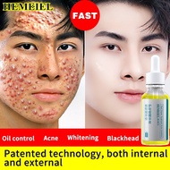 HEMEIEL Sos Pimple Remover/Pimple Marks Acne Spot Treatment/Isotretinoin