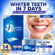 9D Teeth Whitening Strips Personal Oral Hygiene Teeth Whitening Stickers Gel Pemutih Gigi Pemutihan 
