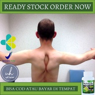 Obat Distrofi Otot Obat Untuk Distrofi Otot Obat Otot Lemah Obat Penguat Otot Obat Pencegahan Atrofi