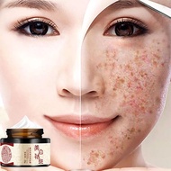 Dark Spot Remover Brightest Skin Anti Aging Pekas Remover Original Pynocare for Melasma Cream 30g【