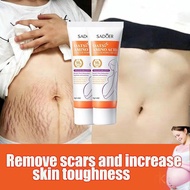 40g removes stretch marks, improves after giving birth, waist, thigh patterns, lightens acne marks, 