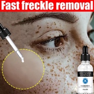 Melasma And Pekas Remover , Face Points , Anti-Aging Wrinkle Cream