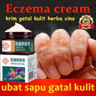 Eczema and antifungal cream herbal plant itchy skin cream psoriasis anti itch cream cream for itchy 