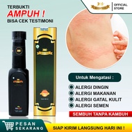 Obat Alergi Paling Ampuh Alergi Dingin Alergi Makanan Alergi Semen Alergi Kulit Gatal Bentol Biduran