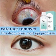 Eye Drops for cataract Medical Eye Wash dry eyes drops Cleaner|Itchy Eyes|Glaucoma|Bloodshot |Sore E