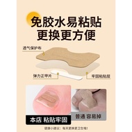 Nail Corrector Nail Corrector Nail Corrector Ingrown Nails Toenail Corrector Dedicated Sticker Toena