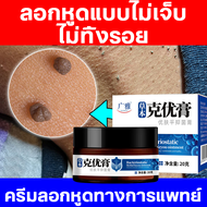 ยาทาหูด ขี้แมลงวัน ติ่งเนื้อ หูด ตาปลา แก้ปัญหา 20g ครีมแต้มไฝคุณยาย ไฝ หูด จี้ไฝ แต้มไฝ หูดและติ่ง 