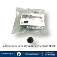 Front-Rear Bumper Clip And Hyundai Wheel Arch Plastic Can Be Used With All Models: 865952T500
