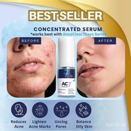 AC7D Serum Concentrated 10ml (Low Stock) - Acne Clear 7 Days | Acne Treatment for Acne-Prone Skin | 