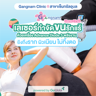 [E-voucher] Gangnam Clinic (Central Ubon) - โปรแกรมเลเซอร์กำจัดขน Advance Diode 3 พลังงาน - บริเวณรั