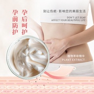 Stretch Mark Repair Cream Reduce Marks Pregnancy Marks Obesity Marks Orange Peel Growth Marks Postpa