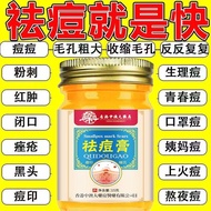 祛痘膏去痘印青春痘粉刺修复淡化痘坑祛痘神器