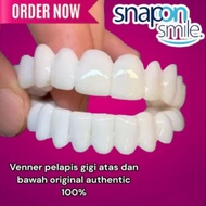 Produk Unik [ Terlaris ] Snap On Smile Venner Perapih Gigi Authentic