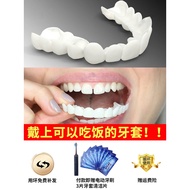 Pendakap gigi nasional makan artifak lelaki dan wanita tua anti-plug gigi hilang gigi pemutihan gigi palsu tampalan gigi