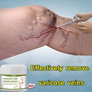 [Best Seller First]  Varicose Veins 50g Varicose Vein Ointment Varicose Vein Cream Intravenous Cream