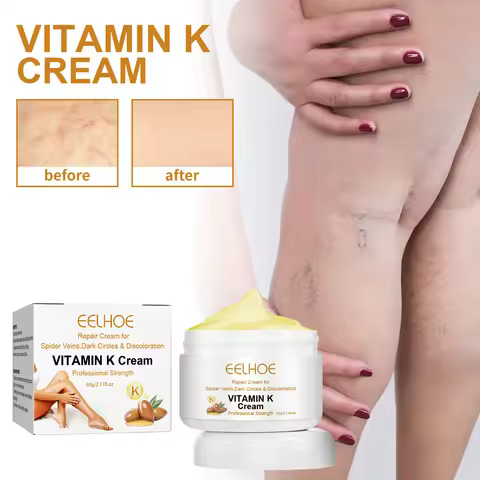 Vitamin K Cream Effective Varicose Vein Relief Cream Massage Care Relieve Leg Soreness Swelling Phle