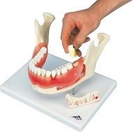 3B Scientific D26 Dental Disease 2x magnification 21-parts - 3B Smart Anatomy
