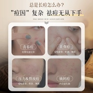 Acne Removal Cream Remove Acne Marks Acne Repair Reduce Acne Marks Scars Men Women Acne Marks Scar R