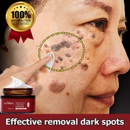 SKIN BLISS Beauty shop japanese melasma cream original pekas remover cream original melasma and peka