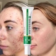 Acne Removal Cream penghilang flek hitam - Salep cina ampuh Penghilang Flek Hitam Membandel Di Wajah