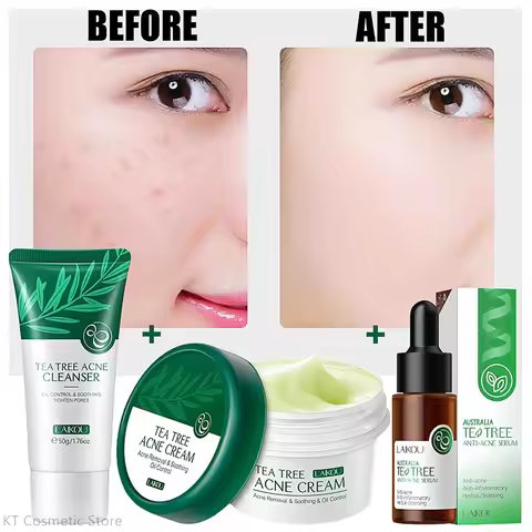 LAIKOU Tea Tree Serum 17ml Anti-Acne Cream 20g Cleanser 50g Plant Extract Refreshing Hydrating Moist