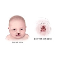 Pigeon Cleft Palate feeding bottle 240ml