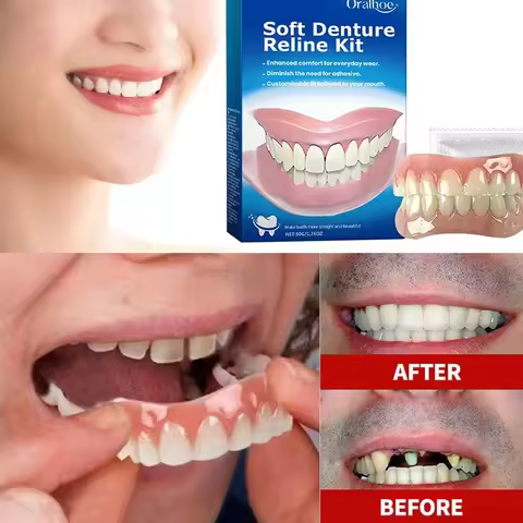 False Teeth Silicone Upper Lower Veneers Perfect Laugh Veneers Dentures Paste Fake Teeth Braces Comf