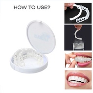 snap on smile untuk gigi