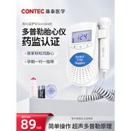 Kangtai Fetal Heart Monitor for Pregnant Women, Home Fetal Heart Monitor, Doppler Fetal Movement Ste