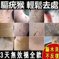 咪奎喹莫特乳膏软膏5%去 疣灵肉粒跖疣瘊灵去除脖子小肉粒尖锐湿疣扁平疣专用非药品男性猴子丝状疣体脱落膏