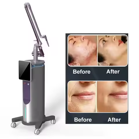 New Fractional Laser Machine Professional Portable Co2 Bison Device 4d Fotona Mini Skin Gestational 
